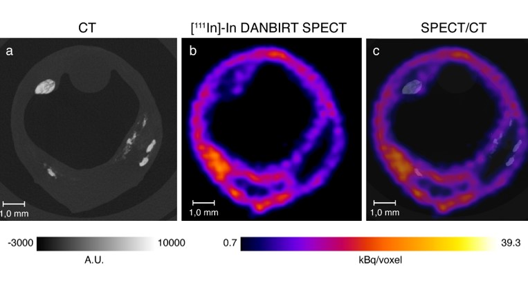 Molecular Imaging of Atherosclerosis