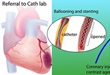 QUANTO-3D-myocardial-perfusion-imaging-with-echography