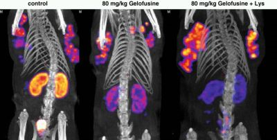 SPECT-CT