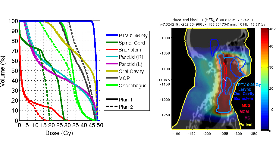 TROTSprojectMatlab169                                                                                                                                                                                                                                                                                                                                                                                                      